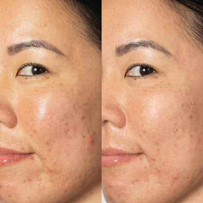 Ole Henriksen Glow2OH Dark Spot Toner